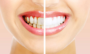 Cosmetic Dentistry